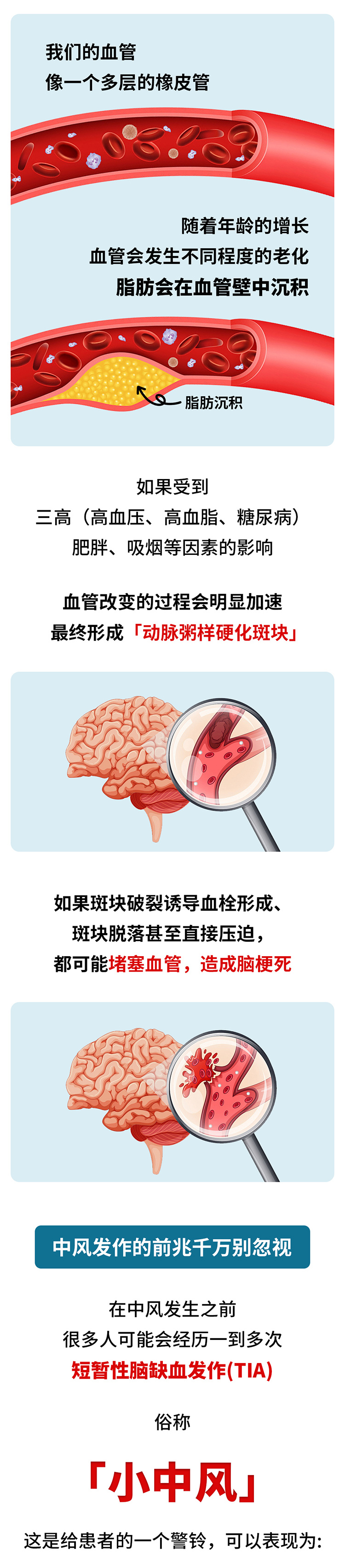 中風(fēng)的5個(gè)前兆，盡早發(fā)現(xiàn)能救命_02.jpg